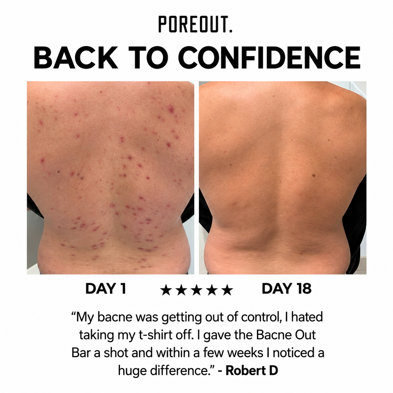 The Pore Bar