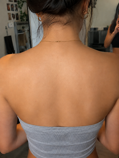 After photo