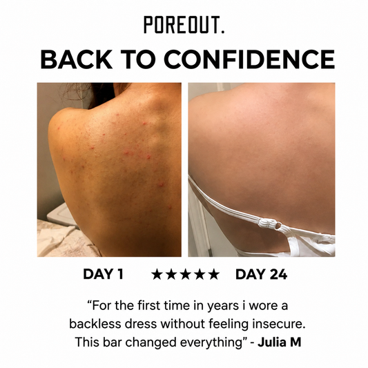 The Pore Bar