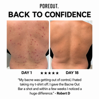 The Pore Bar